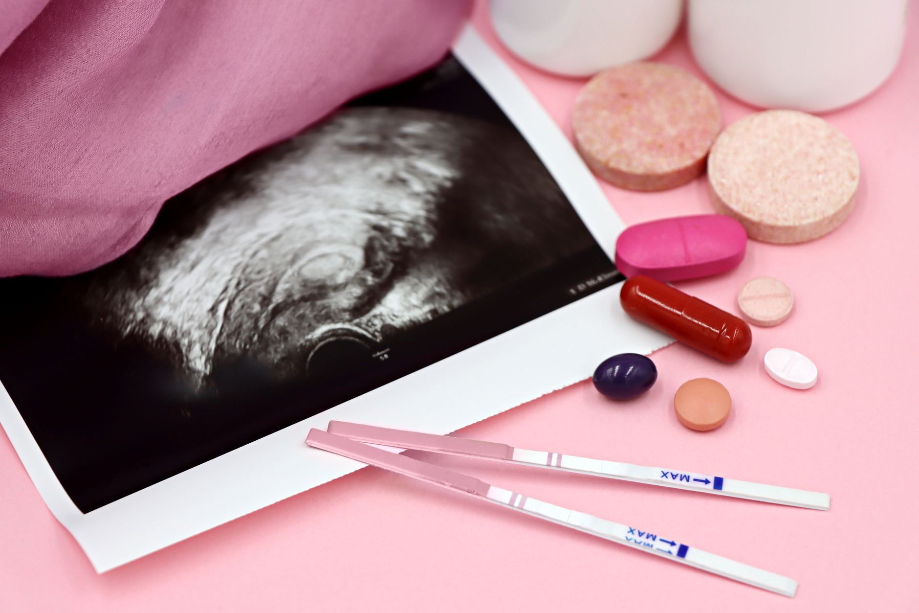 Women encounter unseen fertility limits even with donor eggs