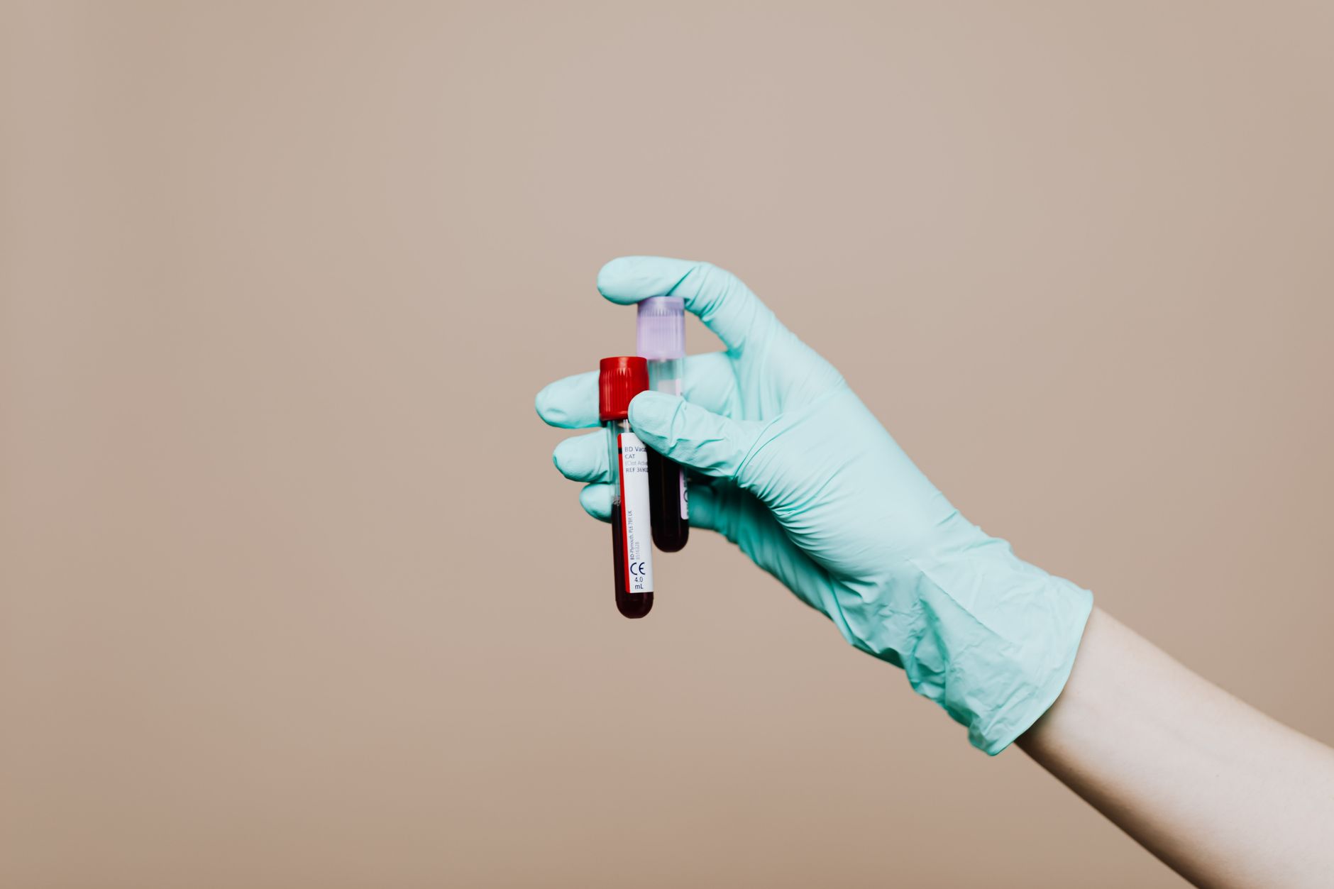 Endometriosis tests could have saved me years of pain