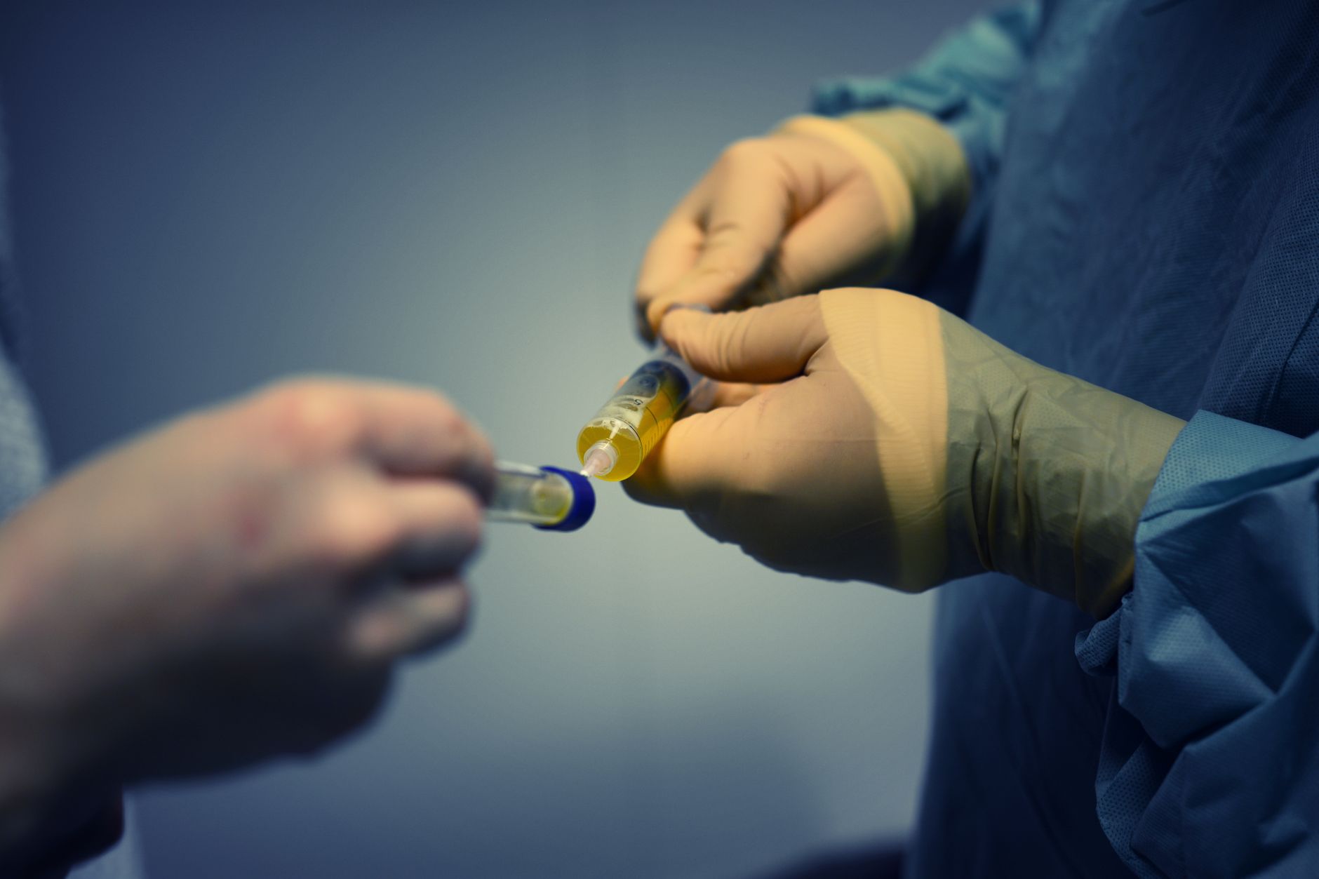 Urine test detects over 90% of bladder cancer cases